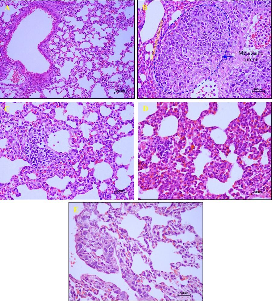 Figure 5: Lungs from Balb/c mice with 4T1 cell induced mammary gland tumour treated with (C) 25mg/kg,