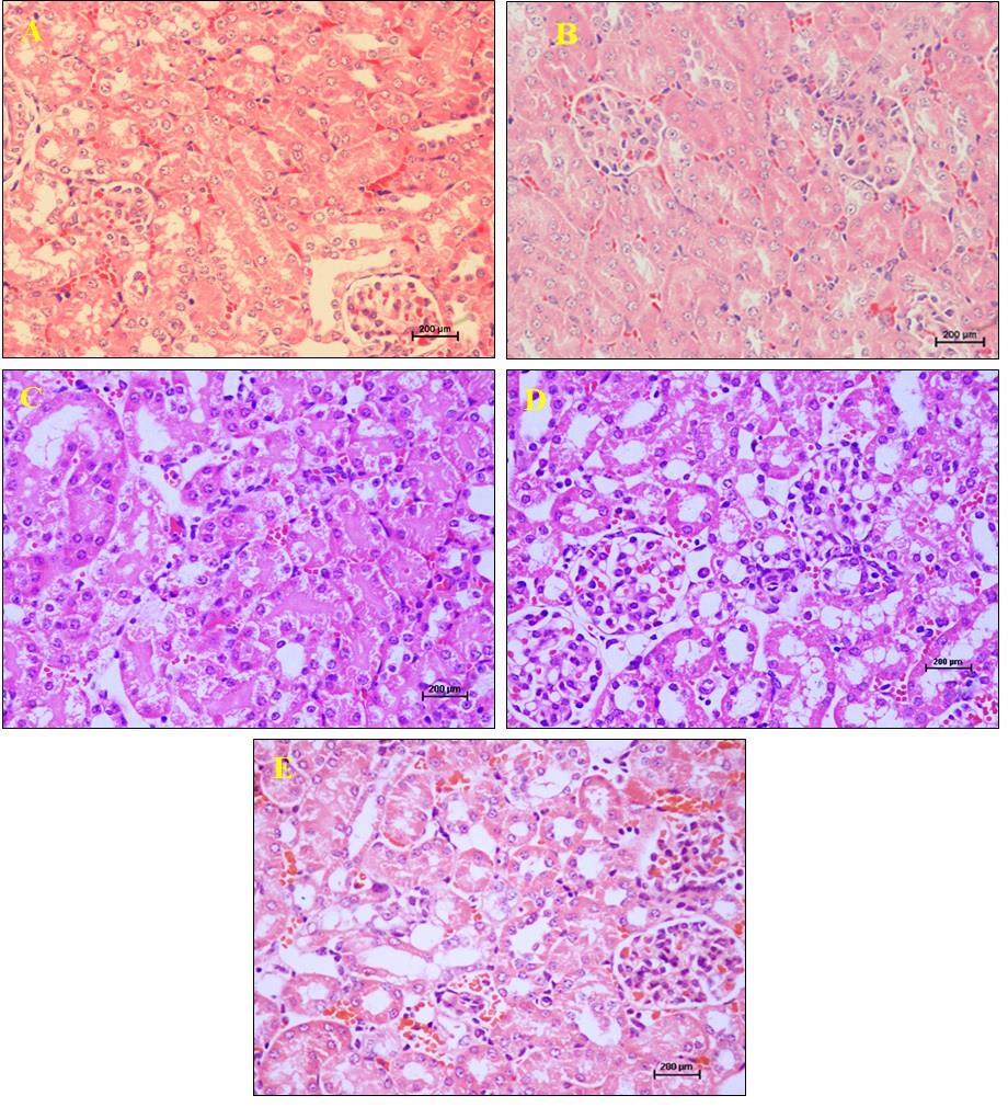 Figure 6: Kidney from Balb/c mice with 4T1 cell induced mammary gland tumour treated with (C) 25mg/kg, (D) 50mg/kg and (E) 100mg/kg of Artonin E.
