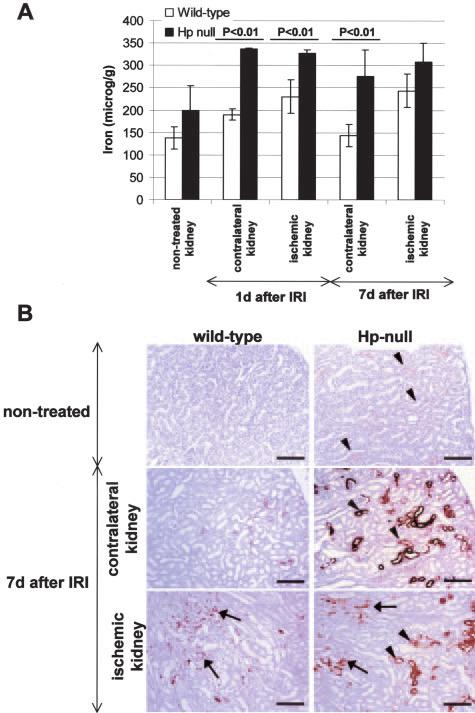 978 Fagoonee et al Figure 4. Hp expression after IRI. A: Western blotting of plasma proteins of a wild-type mouse before and one day after IRI assayed with an anti-hp antibody.