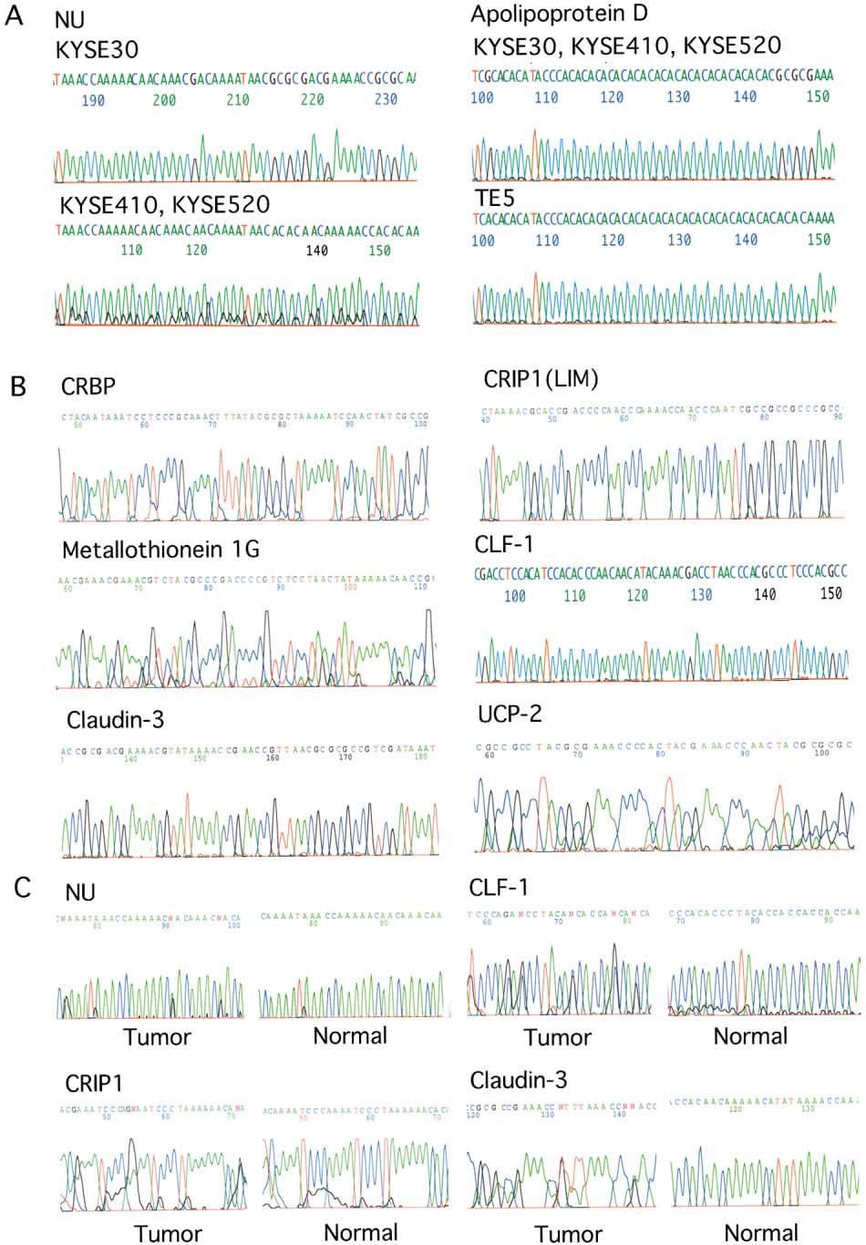 Figure 3. Promoter methylation of representative candidate suppressor genes A: Direct sequence of NU and Apo D promoters.