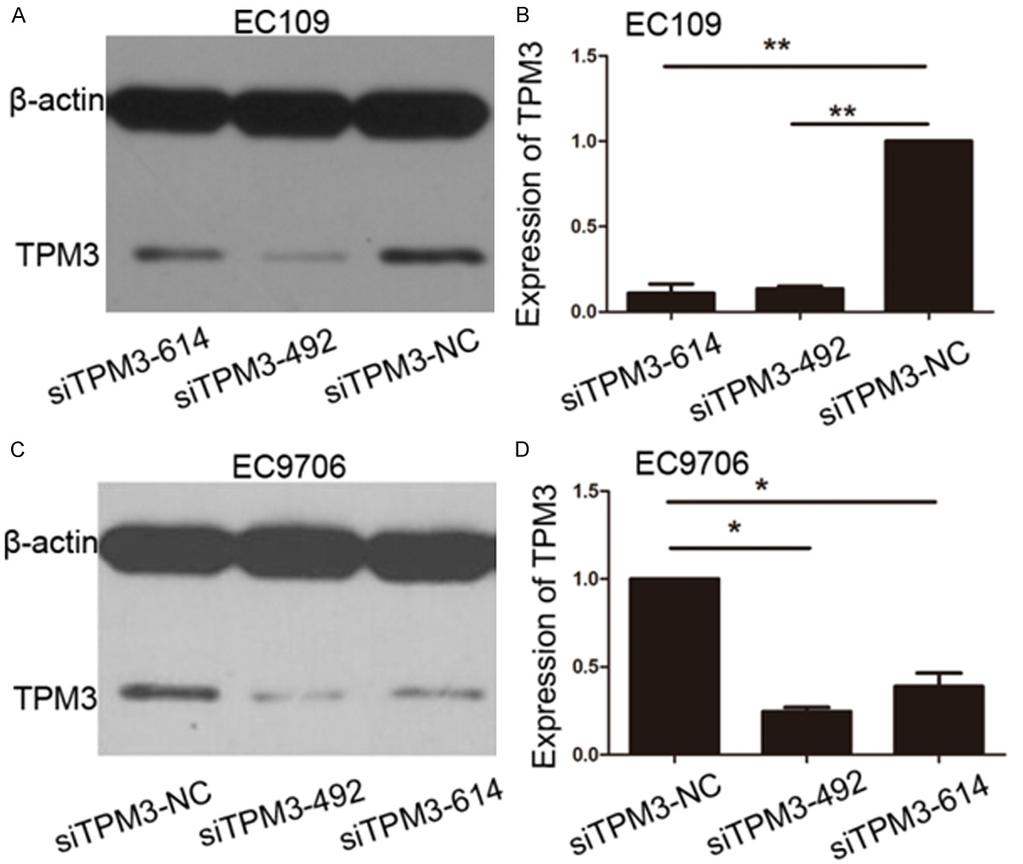 Figure 1. Downregulation of the expression of TPM3 in EC109 and EC9706 measured by Western blot. A, B.