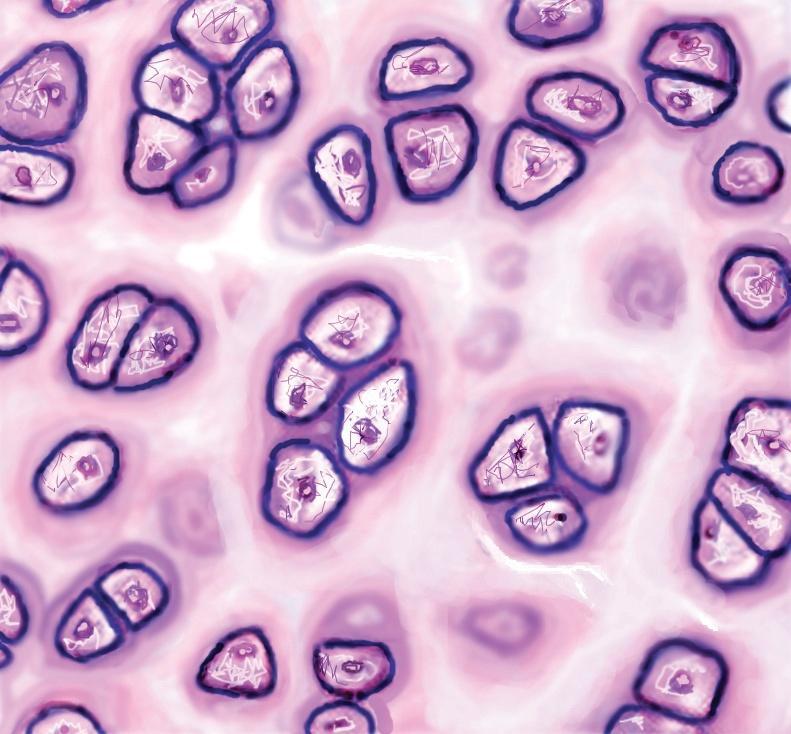 Chondrocyte Lacuna