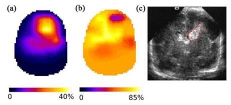 Optical Imaging : Applications Brain: Example of neonates L. Dempsey Proc. SPIE 953818, ECBO (July 16, 2015) HebdenJC.
