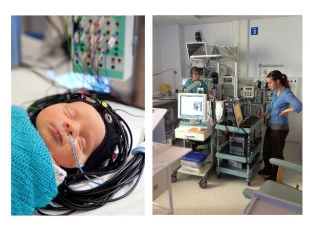 imaging of neonates at cot-side using time-resolved diffuse optical tomography Other application in BRAIN traumatic brain