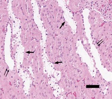 In the renal tubules, glycogen deposition in the tubular epithelium (Armanni- Ebstein lesions) and tubular dilation were noted from 8 weeks of age in SDT fatty rats, and the changes progressed from 8