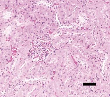 In SDT fatty rats, histopathological findings in the lens, including hyperplasia of epithelium, vacuolation of fiber and morgagnian globules, were observed from 8 weeks of age, and these changes