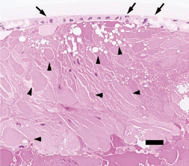 Renal histological lesions of the glomerulus and tubule in ZDF rats were observed after 20 weeks of age [2, 17].