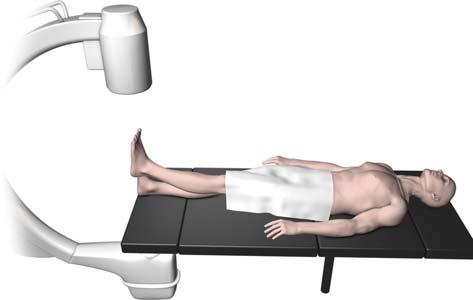Patient Positioning The prone position is preferred, but lateral and supine positions are acceptable if needed.