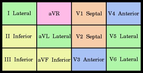 standard color inferior: II,III and avf Chest leads