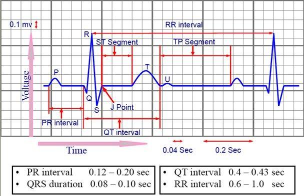 EKG at Rest:Intervals Ask Duration of