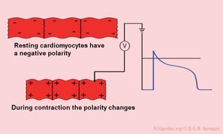 EKG: Depolarization Waves + Depolarized cell Depolarization: cell more positive inside than outside.