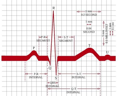 EKG at Rest: Segments PR segment represents the time from the end of atrial depolarization and the beginning of ventricular depolarization.