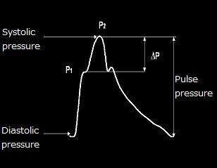 AIX = P2 P1/ PULSE PRESSURE (%) The difference between both pressure peaks reflects the degree to which central arterial pressure is augmented by