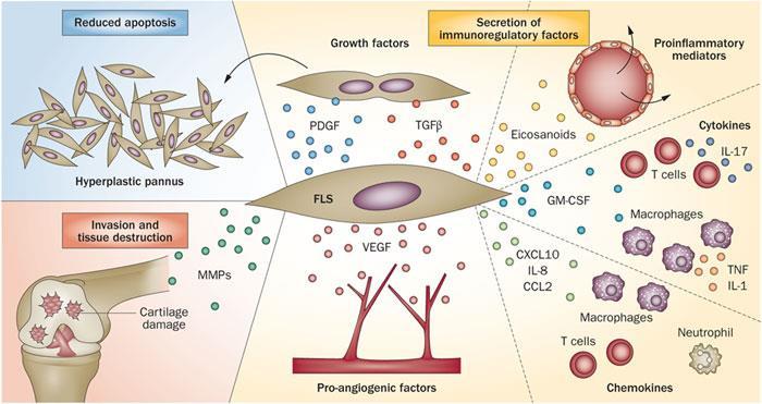 Fibroblast-like Synoviocyte in RA Synovial fibroblasts are key effectors cells in the pathogenesis of RA since they produce a wide variety of mediators of inflammation and joint destruction.