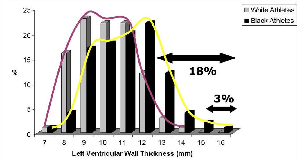 Left Ventricular Wall Thickness in Black Athletes