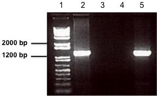 Figure 3-1 Amplified coding sequence of BHMT1 in rat liver sample 1 and 2. Lane 1 shows a 1 Kb DNA ladder.