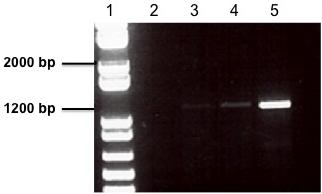 Figure 3-5 Amplified coding sequence of HA-BHMT1 using KAPA Hi-Fi DNA polymerase. Lane 1 shows a 1 Kb DNA ladder. Lane 2 and 4 show control (without DNA) amplified at 65 C and 69 C respectively.