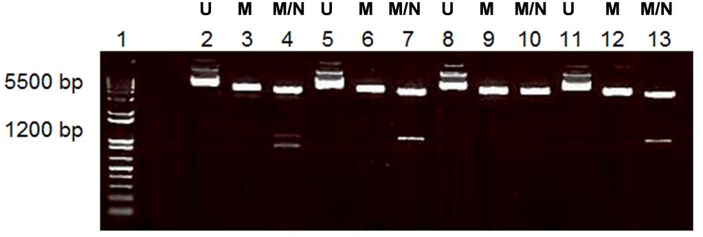 Figure 3-9 PCR-restriction fragment length patterns for BHMT2 obtained after digestion with Mlu1 and Not1. The restriction products were analyzed by 1.5 % agarose gel stained with ethidium bromide.