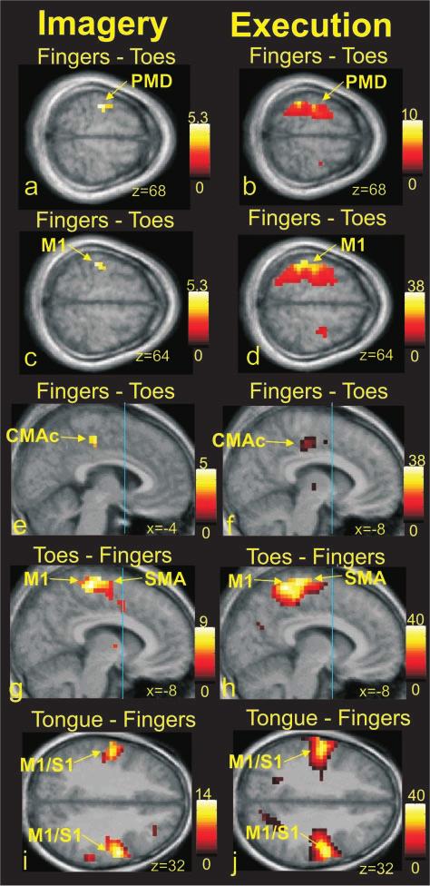 SOMATOTOPIC ACTIVATION DURING MOTOR IMAGERY 3307 detected with the contrast (MOVE FINGERS MOVE TOES)].