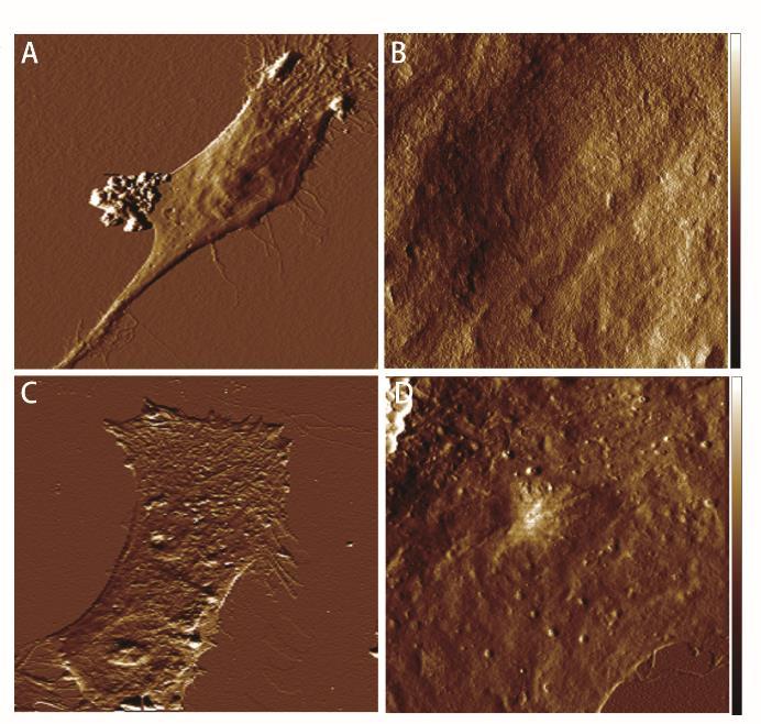 Figure 3: The AFM morphology of young CTs and old CTs. (A) The representative AFM scan image of young cultured CTs. (B) AFM microscopy quantification of surface roughness of (A).