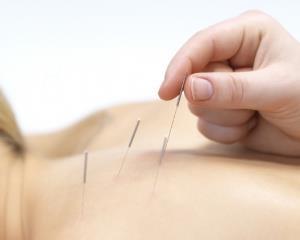 What is Dry Needling (DN)?