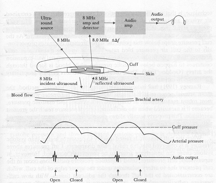Ultrasonic Method A transcutaneous (through the skin) Doppler sensor is applied here. The motion of blood-vessel walls in various states of occlusion is measured.