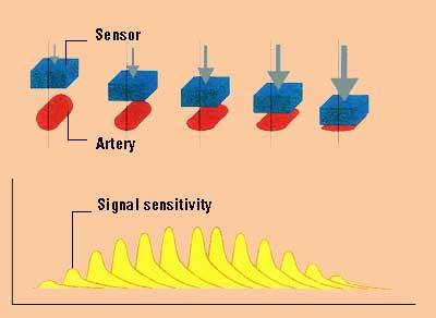 sensors must lay directly above the artery When the blood vessel is