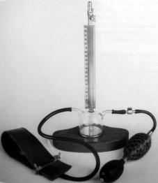 History Indirect blood pressure measurement 1896 The Riva-Rocci sphygmomanometer.