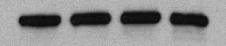 Cells D + +.5 µm Cisplatin MBD2 MCM7 PCNA Supplemental Figure 6.