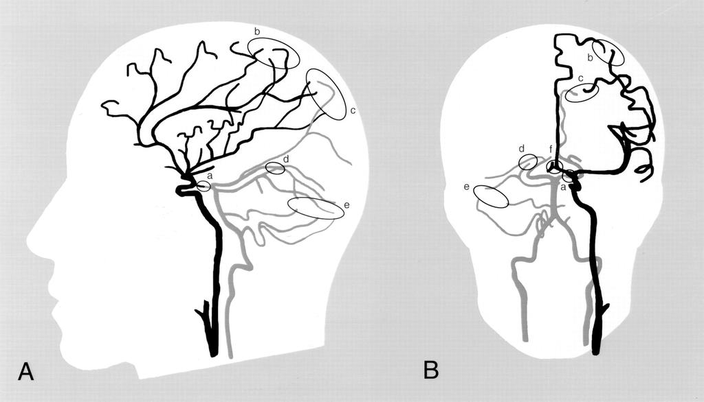 Anterior cerebral circulation and posterior cerebral circulation David S.