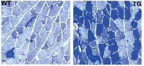 Increased Oxidative Type I Fibers in the PPAR Transgenic Mice Skeletal muscle fibers are generally classified as type I or r type II fibers.