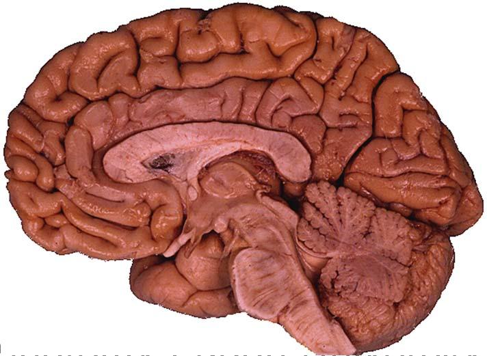 General Appearance of Cerebrum right & left cerebral hemisphere, separated by cerebral longitudinal fissure(1)-
