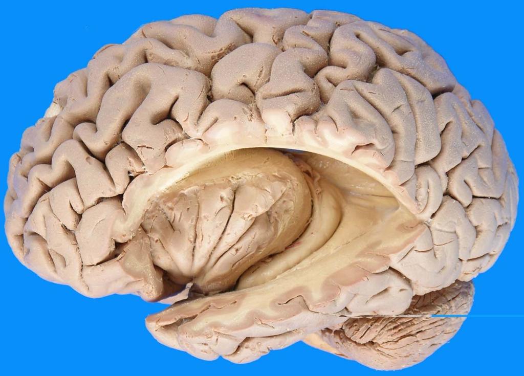 Precentral gyrus Sup.frontal sulcus Central sulcus Inf.