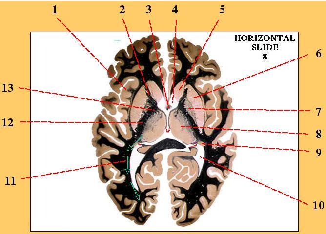 answer 38 1 - insula 2 - internal capsule, ant limb 3 - fornix 4 - lateral ventricle, ant horn 5 - caudate nucleus, head 6 - putamen 7 - globus pallidus