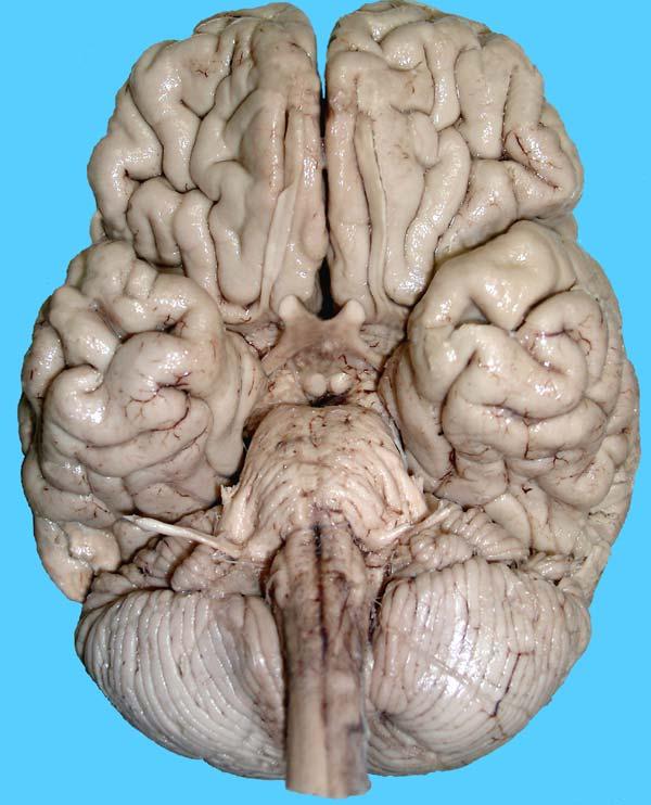 Frontal lobe Olfactory tract Optic n.