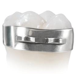 0 olar Band Features haped for a Precise, Tight Fit on Every Tooth Each band has precision shaped tooth anatomy for a