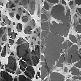 Bone Strength Age-Related Changes in Trabecular Microarchitecture SIZNE & SHAPE
