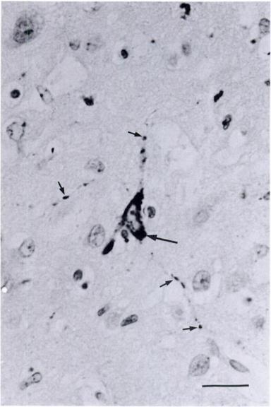 Immunoperoxidase staining of morbillivirus antigen in neuronal cytoplasm and processes (arrows). Mayers hematoxylin counterstain. Bar = 20 tim. lingame, California, USA).