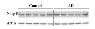 Control AD Naip 5 Actin Naip5 mrna fold change 2.0 1.5 1.0 0.5 0.0 Control NA AD sample Naip 5 Protein fold change 2 1 0 control NA AD sample Figure B.4 Naip 5 expression levels in human samples.