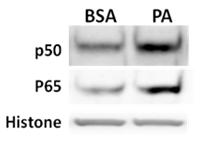 Protein fold change 4 3 2 1 0 BSA PA ** p50 p65 ** Figure B. 6 NFκB levels in nucleus of primary astrocyte. Primary astrocytes were treated with BSA (ctrl) and 0.