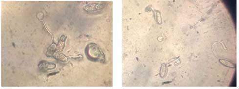 Similar, observations were obtained by Yeasmin and Shamsi (2013) who isolated Alternaria citrii, Aspergillus flavus, A. fumigatus, A. niger, A.