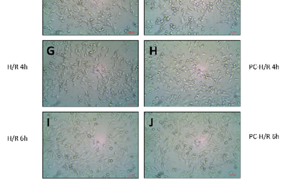 1% hypoxia treated cells, D): PC-H treated cells, E): H/R 2h treated cells, F): PC-H/R 2h treated cells, G): H/R 4h treated cells, H): PC-H/R