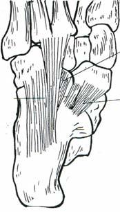 Plantar Fasciitis By Dr John Ebnezar Introduction Plantar fasciitis is a troublesome heel problem that affects people at middle and old age.
