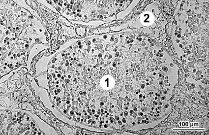 1 - seminiferous epithelium with continuous spermatogenesis, 2 - interstitium, 3 tubule lumen contining