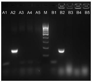 aurisspecific PCR; lane 1, negative control; lane 2, C. auris VPCI 671/P/12; lane 3, C.