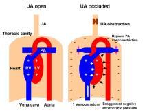 Slide 10 Mechanical Effects of OSA on Heart Function Kasai et al.