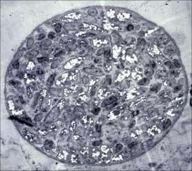 Tachyzoites are sensitive to proteolytic enzymes and are usually destroyed by gastric digestion.