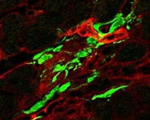 data show egfp-labeled (green) fibroblasts along with αsma (red)