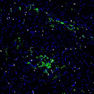 EGFP + fibroblasts are shown in green and CD31 +