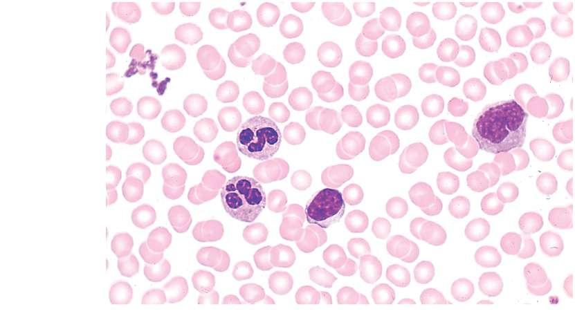 Platelets Monocyte
